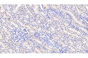Detection of AGMAT in Human Kidney Tissue using Polyclonal Antibody to Agmatine Ureohydrolase (AGMAT)