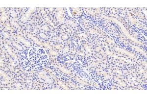 Detection of AGMAT in Human Kidney Tissue using Polyclonal Antibody to Agmatine Ureohydrolase (AGMAT) (AGMAT anticorps  (AA 53-151))