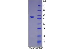 SDS-PAGE (SDS) image for Transferrin (TF) ELISA Kit (ABIN6574112)