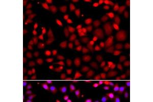 Immunofluorescence analysis of A549 cells using MTUS1 Polyclonal Antibody (MTUS1 anticorps)