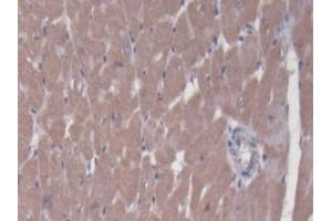 Detection of BCAT1 in Rat Heart Tissue using Polyclonal Antibody to Branched Chain Aminotransferase 1, Cytosolic (BCAT1) (BCAT1 anticorps  (AA 179-411))