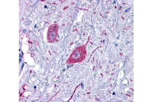Anti-GPR6 antibody  ABIN1048845 IHC staining of human brain, neurons and glia.