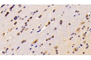 Detection of RGS6 in Rat Cerebrum Tissue using Polyclonal Antibody to Regulator Of G Protein Signaling 6 (RGS6)
