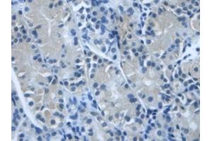 DAB staining on IHC-P; Samples: Human Stomach Tissue (TGFBI anticorps  (AA 423-632))