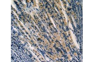 Used in DAB staining on fromalin fixed paraffin- embedded stomach tissue