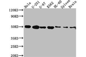 Western Blot Positive WB detected in: Hela whole cell lysate, U-251 whole cell lysate, U-87 whole cell lysate, K562 whole cell lysate, HL-60 whole cell lysate, Rat Spleen whole cell lysate, Rat Brain whole cell lysate All lanes: Dopamine Receptor D3 antibody at 1:1000 Secondary Goat polyclonal to rabbit IgG at 1/50000 dilution Predicted band size: 45, 41 kDa Observed band size: 50 kDa (Recombinant DRD3 anticorps)
