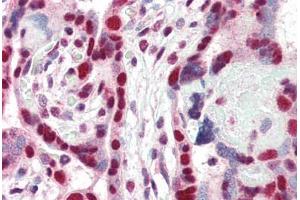 Human Placenta (formalin-fixed, paraffin-embedded) stained with CBX3 antibody ABIN337123 at 2. (CBX3 anticorps  (AA 74-87))