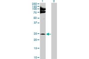 Western Blot analysis of NQO2 expression in transfected 293T cell line by NQO2 MaxPab polyclonal antibody. (NQO2 anticorps  (AA 1-231))