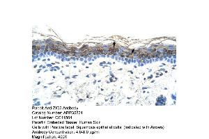 Human Skin (ZIC2 anticorps  (C-Term))