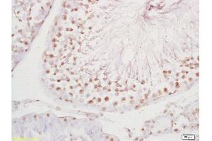 Formalin-fixed and paraffin embedded rat testis tissue labeled with Anti-PLCZ1 Polyclonal Antibody, Unconjugated at 1:200 followed by conjugation to the secondary antibody and DAB staining
