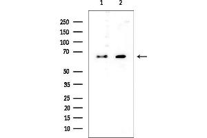 Western blot analysis of lysates from various samples, using GPC3 Mouse Monoclonal Antibody at 1/1000 dilution.