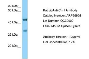 Western Blotting (WB) image for anti-Cannabinoid Receptor 1 (CNR1) (C-Term) antibody (ABIN970424) (CNR1 anticorps  (C-Term))