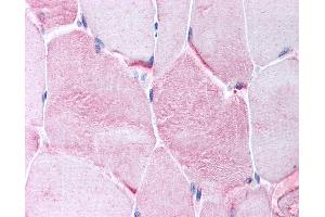 Anti-CACNG1 antibody IHC of human skeletal muscle.