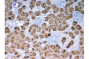 IHC analysis of PAH using anti-PAH antibody .