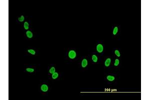 Immunofluorescence of  purified  MaxPab antibody to PTBP1 on HeLa cell.