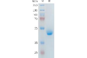Human R1(21-164) Protein, hFc Tag on SDS-PAGE under reducing condition.
