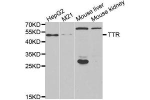 Western Blotting (WB) image for anti-Transthyretin (TTR) antibody (ABIN3017544) (TTR anticorps)