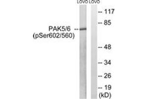 Western blot analysis of extracts from LOVO cells treated with PMA 125ng/ml 30', using PAK5/6 (Phospho-Ser602/Ser560) Antibody. (PAK5/6 (AA 566-615), (pSer602) anticorps)