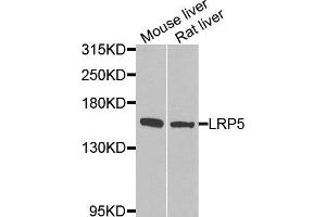 Western blot analysis of extracts of various tissues, using LRP5 antibody. (LRP5 anticorps  (AA 1000-1250))