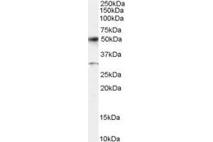Western Blotting (WB) image for anti-Activating Transcription Factor 2 (ATF2) (AA 492-505) antibody (ABIN292594)