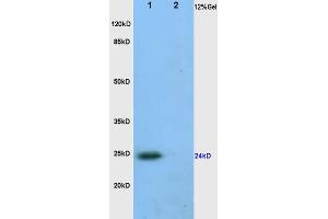 L1 human colon carcinoma, L2 rat heart lysates probed (ABIN872390) at 1:200 in 4 °C.