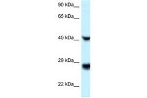 Image no. 1 for anti-Ras-Like Without CAAX 1 (RIT1) (C-Term) antibody (ABIN6747636) (RIT1 anticorps  (C-Term))