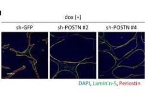 Periostin knockdown inhibited mesenchymal cell proliferation and maintained non-invasive phenotype in TNBC tumors.