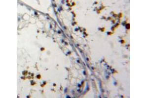 IHC-P analysis of testis tissue, with DAB staining. (NUP62 anticorps  (AA 186-432))