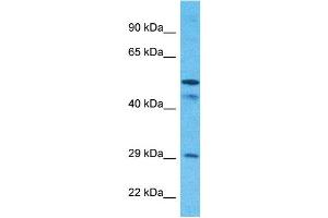 Host:  Rabbit  Target Name:  SCMC1  Sample Type:  MCF7 Whole Cell lysates  Antibody Dilution:  1.