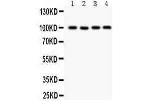 Anti- TRP 7 Picoband antibody, Western blotting All lanes: Anti TRP 7  at 0. (TRPC7 anticorps  (AA 716-862))