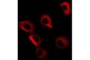 Immunofluorescent analysis of GP73 staining in MCF7 cells. (GOLM1 anticorps)
