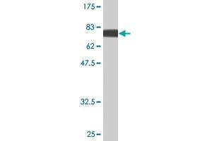 Western Blot detection against Immunogen (75. (PIK3R1 anticorps  (AA 1-454))