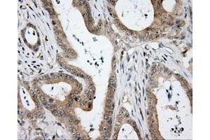 Immunohistochemical staining of paraffin-embedded Kidney tissue using anti-HDAC10 mouse monoclonal antibody. (HDAC10 anticorps)