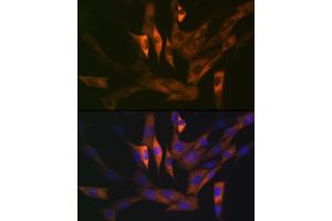 Immunofluorescence analysis of NIH-3T3 cells using Stathmin 1 Rabbit mAb (ABIN1678518, ABIN3018873, ABIN3018874 and ABIN7101680) at dilution of 1:100 (40x lens).