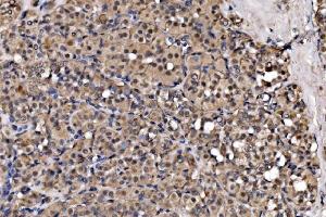 IHC analysis of EXOSC3 using anti-EXOSC3 antibody (ABIN7602216).
