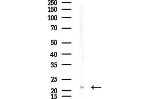 anti-CKLF-Like MARVEL Transmembrane Domain Containing 3 (CMTM3) (N-Term) antibody