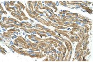 Immunohistochemical staining (Formalin-fixed paraffin-embedded sections) of human muscle with HAL polyclonal antibody  at 4-8 ug/mL working concentration. (HAL anticorps  (C-Term))