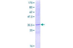 Image no. 1 for serine Peptidase Inhibitor, Kazal Type 2 (Acrosin-Trypsin Inhibitor) (SPINK2) (AA 1-84) protein (GST tag) (ABIN1321183)