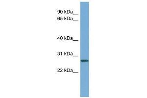 Western Blot showing CCNDBP1 antibody used at a concentration of 1-2 ug/ml to detect its target protein. (CCNDBP1 anticorps  (Middle Region))
