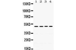 Western Blotting (WB) image for anti-Damage-Specific DNA Binding Protein 2, 48kDa (DDB2) (AA 1-115) antibody (ABIN3043488) (DDB2 anticorps  (AA 1-115))