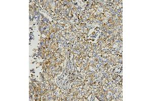 IHC analysis of AIF using anti-AIF antibody (ABIN6719266).