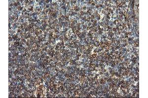 Image no. 7 for anti-Transmembrane Protein 173 (TMEM173) antibody (ABIN1501428)