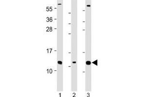 Western blot testing of human 1) Caco-2, 2) RMPI-8226 and 3) SH-SY5Y cell lysate with CKS2 antibody at 1:2000.