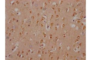 IHC image of ABIN7127314 diluted at 1:100 and staining in paraffin-embedded human brain tissue performed on a Leica BondTM system. (Recombinant HTR2C anticorps)