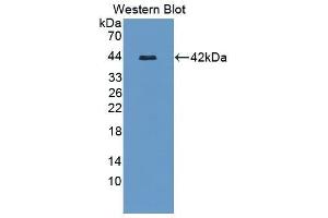 Western Blotting (WB) image for anti-serpin Peptidase Inhibitor, Clade D (Heparin Cofactor), Member 1 (SERPIND1) (AA 256-342) antibody (ABIN1868333) (SERPIND1 anticorps  (AA 256-342))