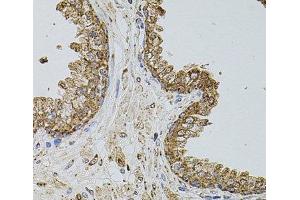 Immunohistochemistry of paraffin-embedded Human prostate using SELP Polyclonal Antibody at dilution of 1:100 (40x lens). (P-Selectin anticorps)