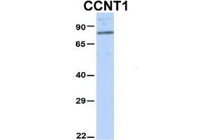 Host:  Rabbit  Target Name:  CCNT1  Sample Type:  Hela  Antibody Dilution:  1. (Cyclin T1 anticorps  (N-Term))