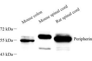 Western blot analysis of peripherin (ABIN7075012) at dilution of 1: 1000