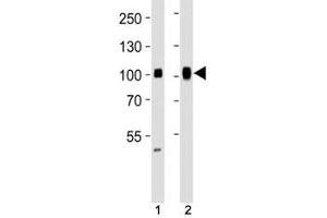 Western blot analysis of lysate from (1) HeLa and (2) Ramos cell line using SP1 antibody at 1:1000.