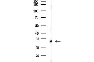 anti-Integrin-Binding Sialoprotein (IBSP) (Internal Region) antibody